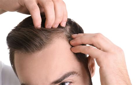 Can Hair Grow Back After Thinning Need Circle