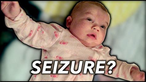 Help I Think My Baby Is Having Seizures Dr Paul Youtube