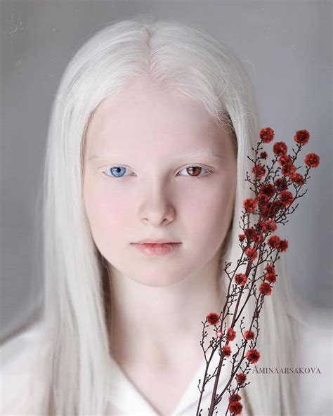 Retratos Et Reos Destacam A Beleza Nica De Uma Menina Com Albinismo E