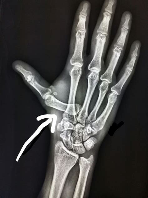77 Best Unusual X Rays Images On Pinterest Radiology