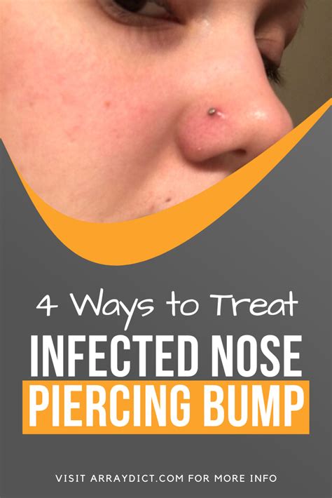 4 things to treat infected nose piercing bump without closing it piercing bump nose piercing