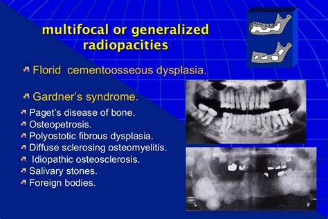 Oral Radiology Intro Differential Diagnosis