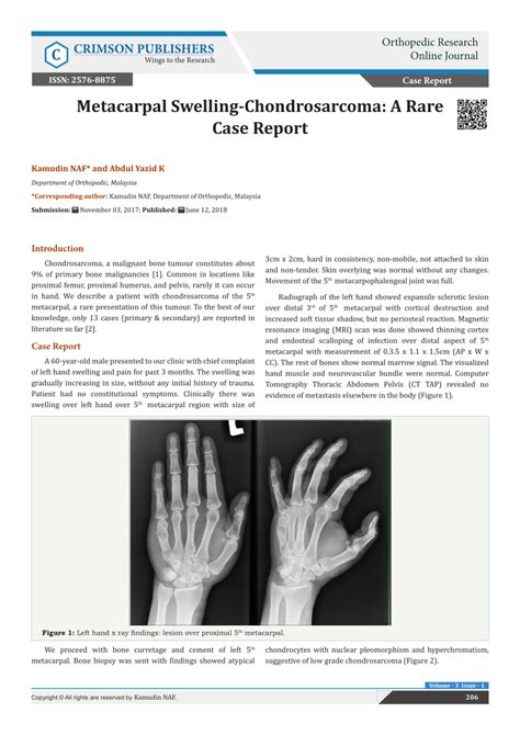 Pdf Metacarpal Swelling Chondrosarcoma A Rare Case Report