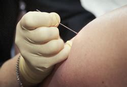 Smallpox vaccine is an active, replicating viral vaccine administered using a multiple puncture technique with a bifurcated needle. Vaccination Strategies | Smallpox | CDC