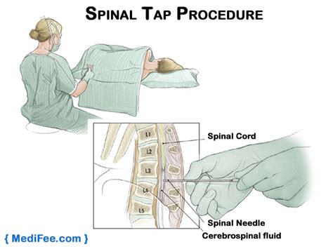 Brain Tumor Diagnosis In India