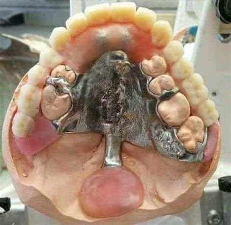 An Open Mouth With Teeth And Gums On It