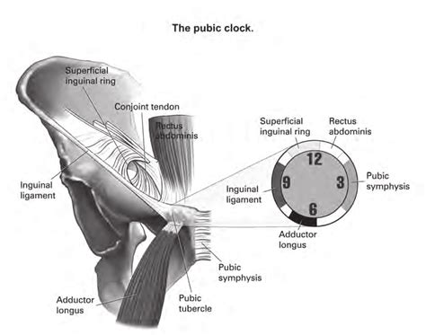 The groin is the area that lies between the abdomen stomach and thighs. A clock-wise orientation on the anatomy of the groin region as... | Download Scientific Diagram