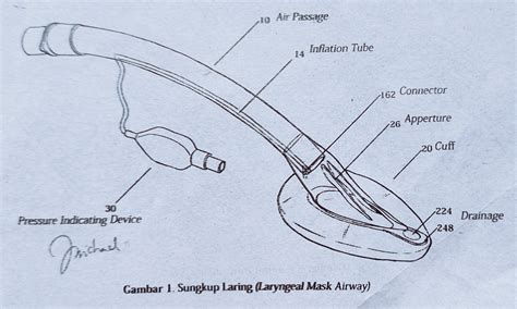Tatalaksana Jalan Nafas Lanjut % - Mediaperawat.id