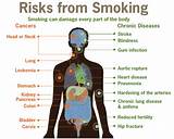Smoking Cigarettes While Pregnant Side Effects Pictures