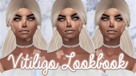 The Sims 4 Lookbook Vitiligo Full Cc List Youtube