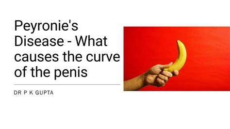 Peyronies Disease What Causes The Curve Of The Penis By Dr Pk Gupta Issuu
