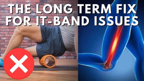 How To Fix A Tight It Band Or Outer Leg Addressing The Root Cause