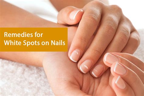 What Are White Spots On Nails Caused From Design Talk