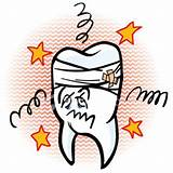 Is A Broken Tooth A Dental Emergency Photos