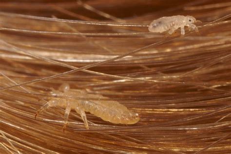 Head Lice Becoming Immune To Treatments Mirror Online