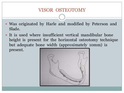 Pre Prosthetic Surgery