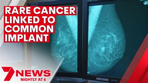A Warning On The Link Between Some Breast Implants And Cancer 7news Youtube