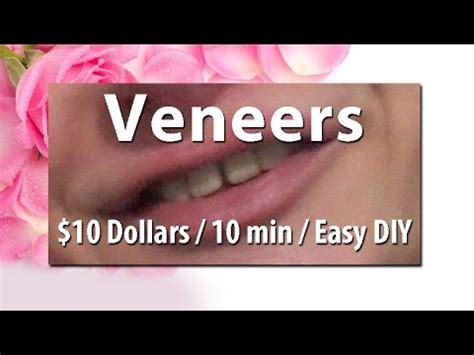 Dental veneers are thin covers that adhere to teeth to give teeth a more classically shaped look. $10 Veneers DIY at home - Cher in Mini DIY Show - YouTube