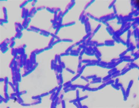 How Can I Identify These Three Types Of Gram Positive