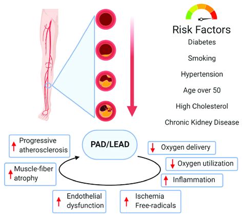 The Main Risk Factors For The Progression Of Peripheral Artery Disease