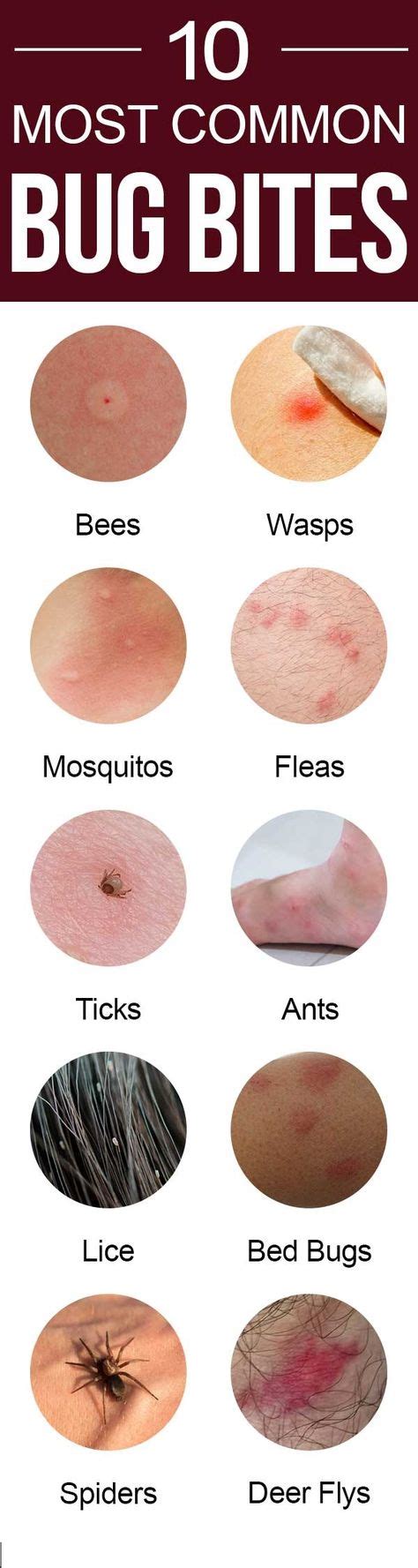 Most Common Bug Bites And How To Identify Them Bug Bites Bug