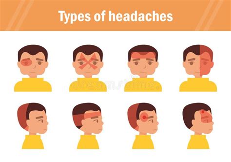 Types Of Headaches Set Of Headache Types Stock Vector