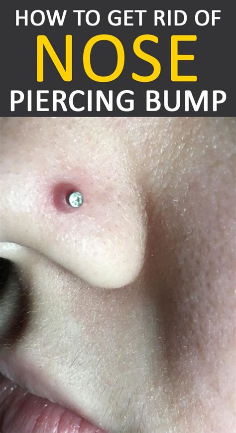 How To Get Rid Of Nose Piercing Bump Piercing Bump Nose Piercing