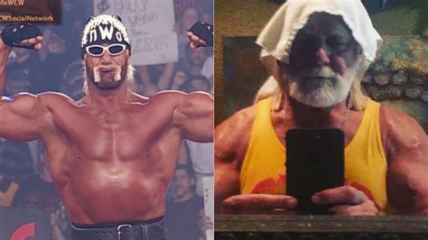 Hulk Hogan Hair Loss