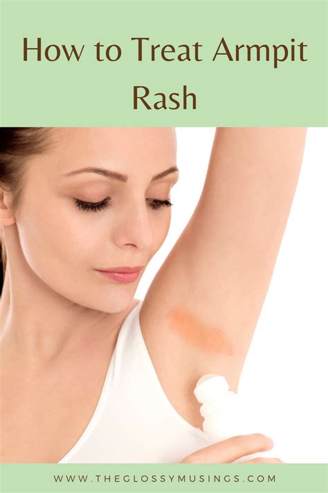 How To Get Rid Of Armpit Rash Armpit Rash Underarm Rash Types Of Skin Rashes