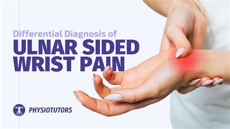 Ulnar Sided Wrist Pain Differential Diagnosis Youtube