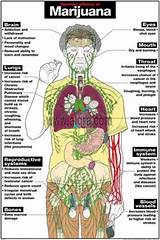 Marijuana Health Side Effects Images