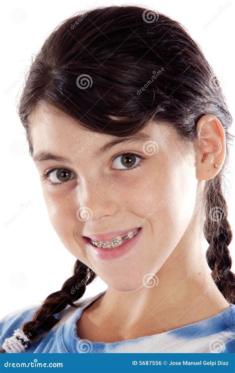 Adorable Girl With Braces Royalty Free Stock Image Image 5687556