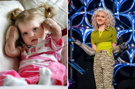 Survivor And Superhero The Story Of Bionic Girl Tilly Lockey As She Celebrates Her Sweet