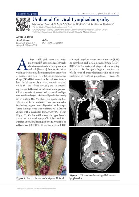 Pdf Unilateral Cervical Lymphadenopathy