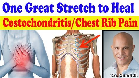 One Great Stretch To Heal Costochondritis Pain In Chest And Ribs Dr