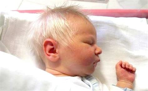 Baby Born With Full Head Of Gray Hair Wins The Hearts Of