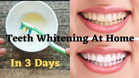 Teeth Whitening At Home How To Whiten Your Yellow Teeth Naturally