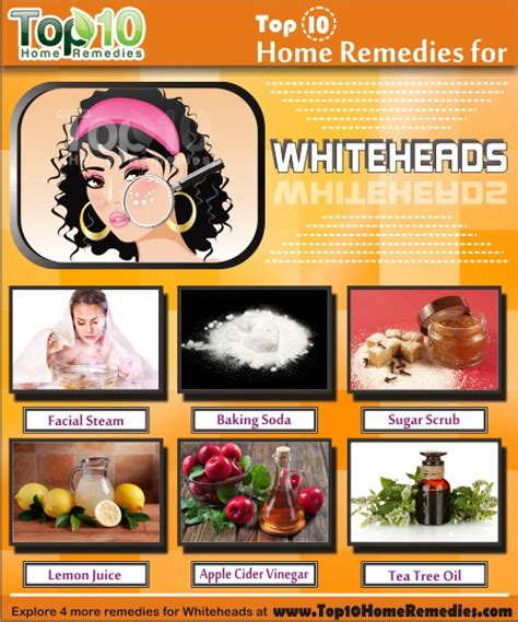 Home Remedies For Whiteheads Top 10 Home Remedies
