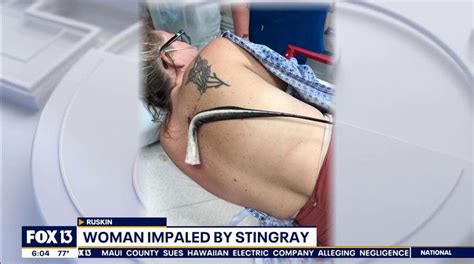 florida woman impaled by stingray while wading at beach certain that i was going to die fox