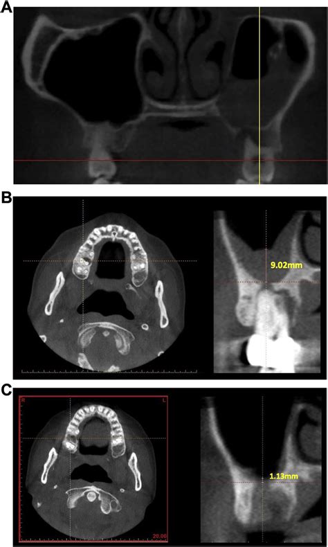 Representative Images Of Cross Sectional Cone Bean Computed Tomography