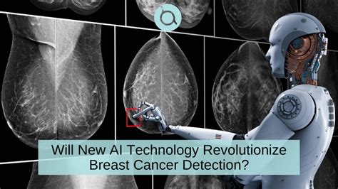 Breast Advocate App ® Breast Advocate® Appai May More Accurately