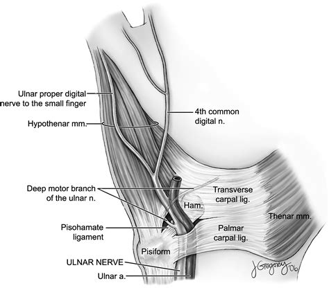 Ulnar Nerve Anatomy Hand Clinics