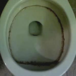 Black Mold In Toilet How To Remove Mold From Bowl Tank And Seat