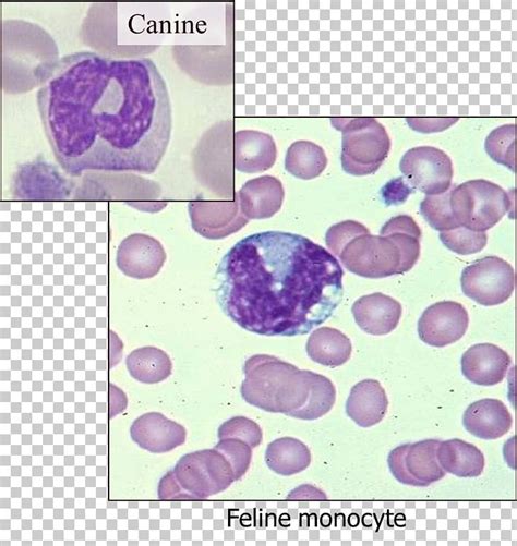 Monocyte Hematology Monocytosis Blood Dog Png Clipart Blood Cancer