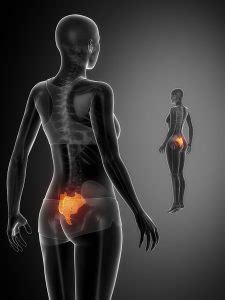 For example, it could be a symptom of spinal stenosis, a kidney infection or even cancer in the worst scenario. Lower Back Pain: Treatment, Causes, Types, Symptoms Relief ...