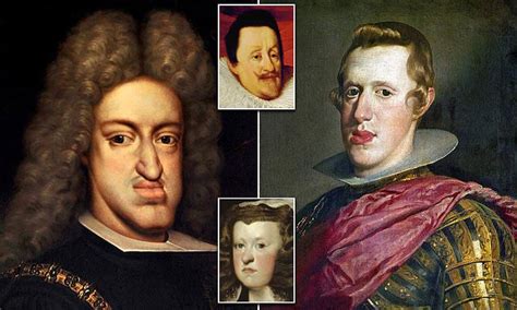 The habsburg jaw, which is also known as the habsburg lip, is one of the most common genetic disorders there are many examples of inbreeding that have been spread throughout the history of. UK Home | Daily Mail Online