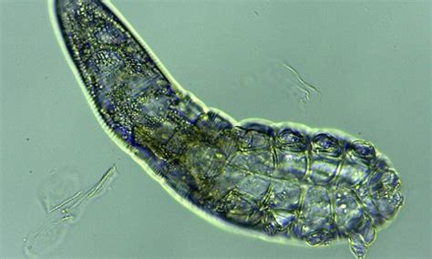 The Microscopic Mites That Live On Your On Your Face Daily Mail Online