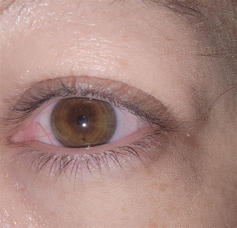Do I Have Central Heterochromia What Color Would You Say My Eyes Are