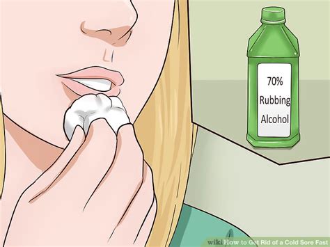 8 Proven Ways To Get Rid Of A Cold Sore Fast Natural Remedies