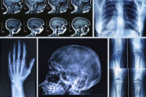 What Is The Difference Between An X Ray Ct And Mri Scan